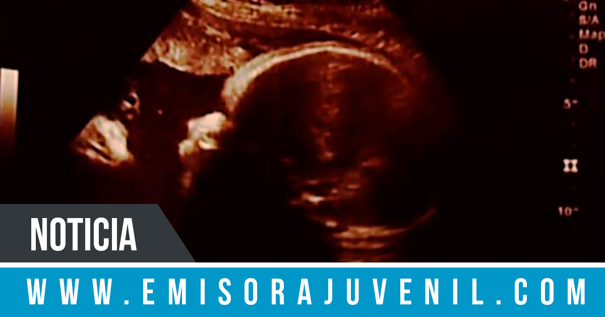 PORTADA: Pareja asegura que Jesús aparece observando a su bebé en ultrasonido