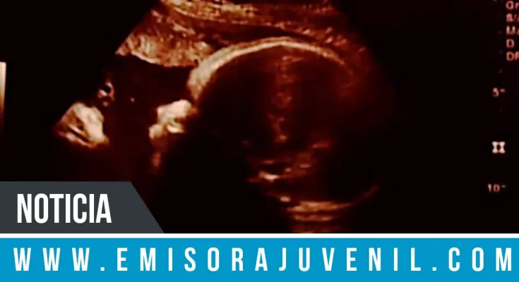 Pareja asegura que Jesús aparece observando a su bebé en ultrasonido - Noticias Cristianas - Emisora Juvenil